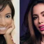 anitta-revela-pressao-por-beleza-na-carreira:-‘eu-era-feia’