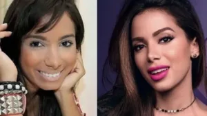 anitta-revela-pressao-por-beleza-na-carreira:-‘eu-era-feia’