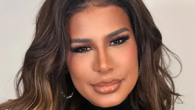 Simone Mendes responde críticas após mudança no nariz: ‘Me deixem respirar’