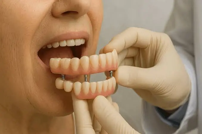 dentadura-de-graca-pelo-sus:-cidade-de-goias-entrega-4,7-mil-proteses;-veja-como-conseguir