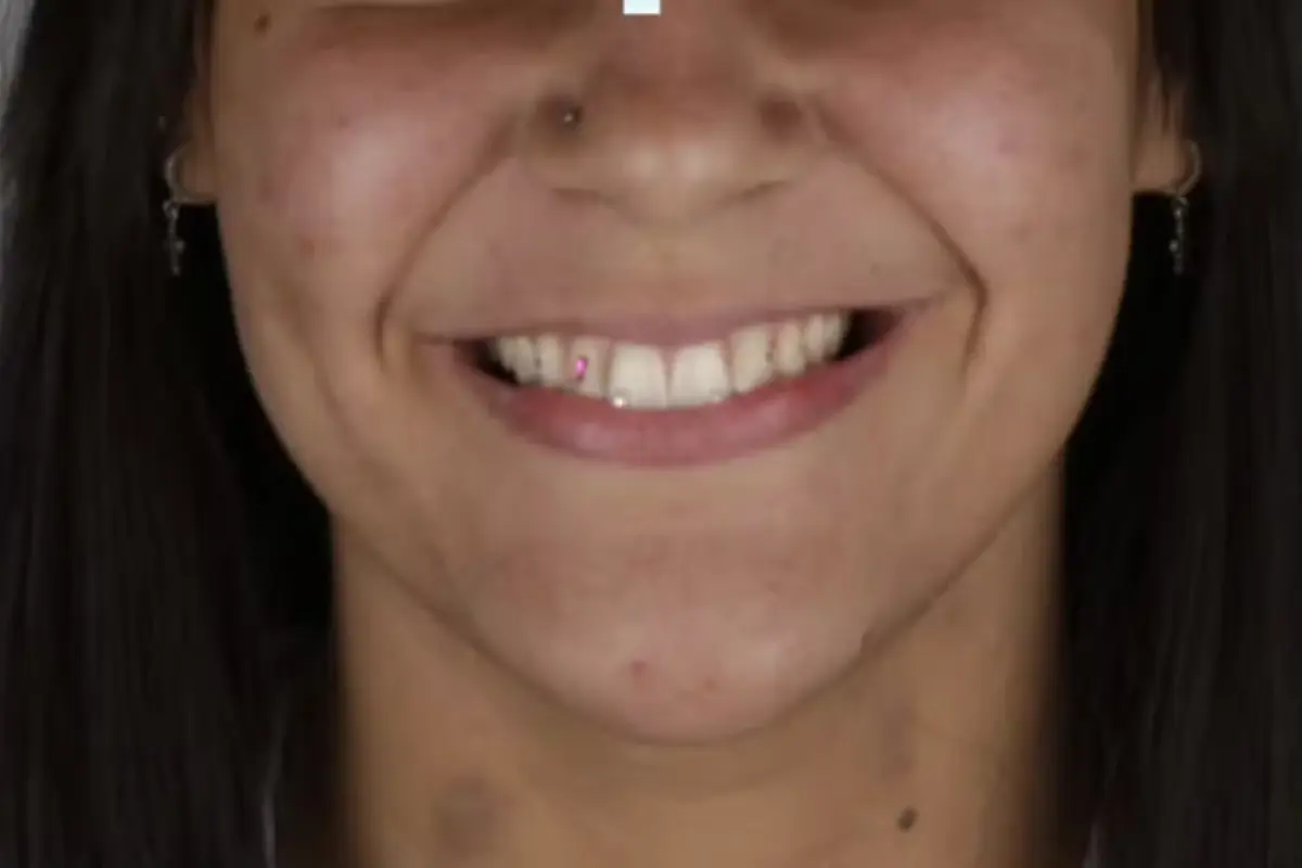 mulher-e-presa-apos-sair-sem-pagar-por-cristais-nos-dentes-em-trindade