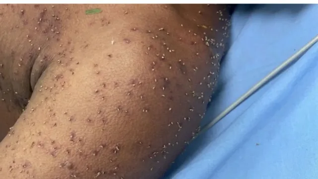 Homem é encontrado desacordado após ataque de enxame de abelhas em Itapuranga