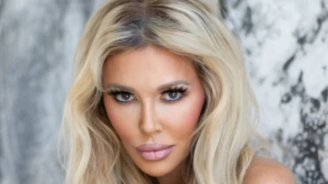 Ex-modelo Brandi Glanville opera o rosto após quatro anos de inchaço e suspeita de fungos sob a pele